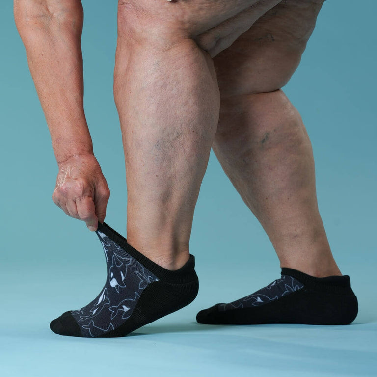 Orca Dance Ankle Socks